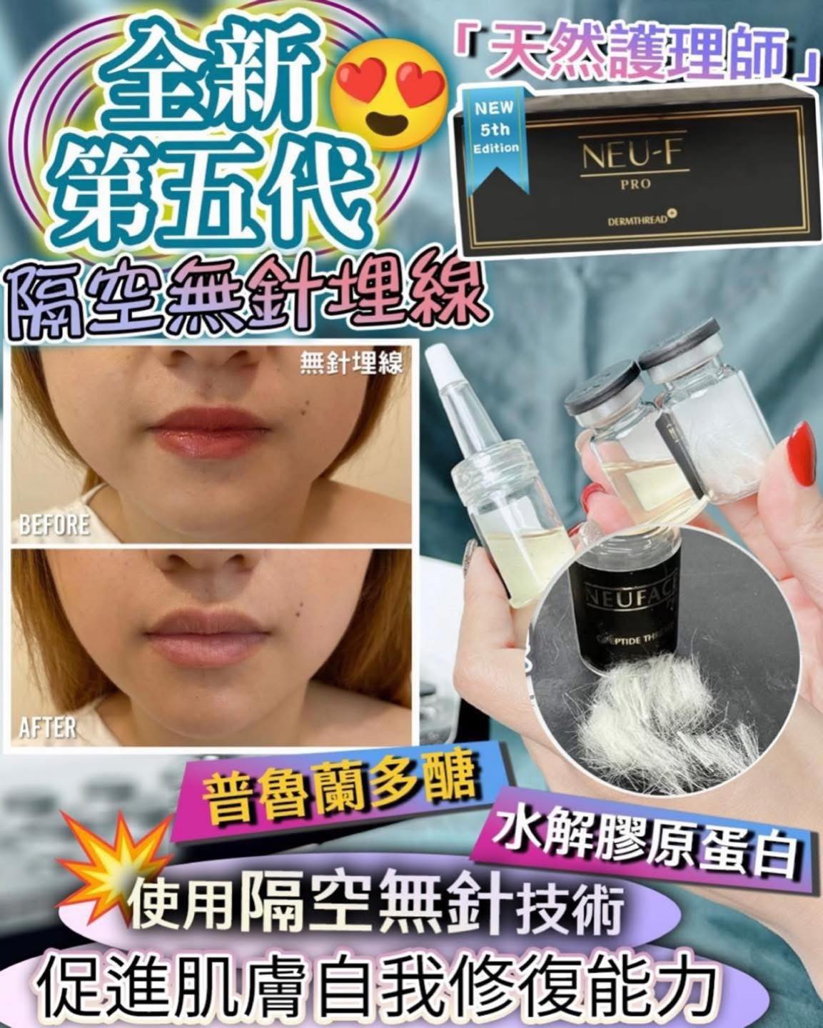 Neuface Pro 全新第5代隔空無針埋線升級版  (訂貨4-7天)