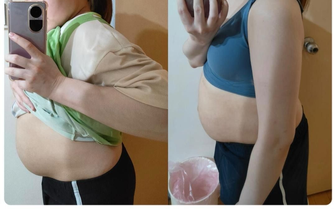 🇲🇾 5 盒 完整一个疗程配套 （ 可服用 30-45 天 ）