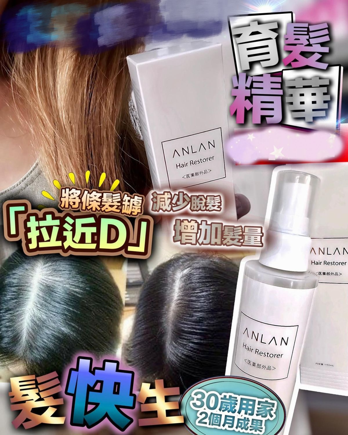 日本🇯🇵ANLAN🇯🇵髮快生 育髮精華150ml