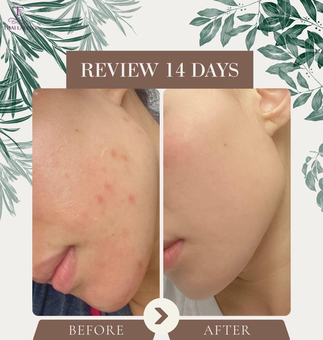 *🌟鑽石神仙去疤油*