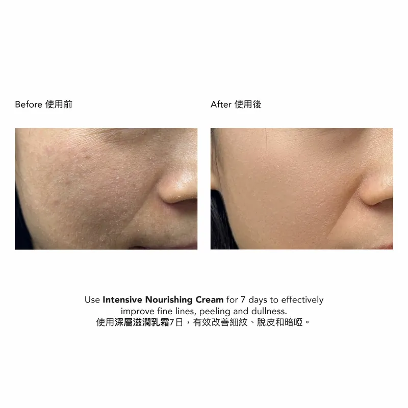 Epionce Intensive Nourishing Cream 深層滋潤乳霜