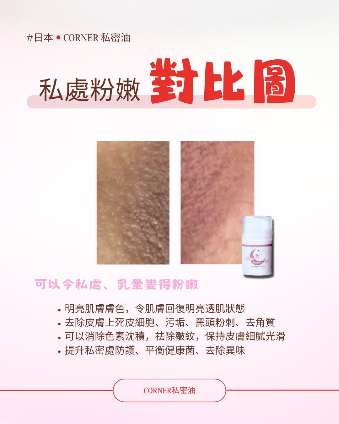 日本CORNER私密呵護油