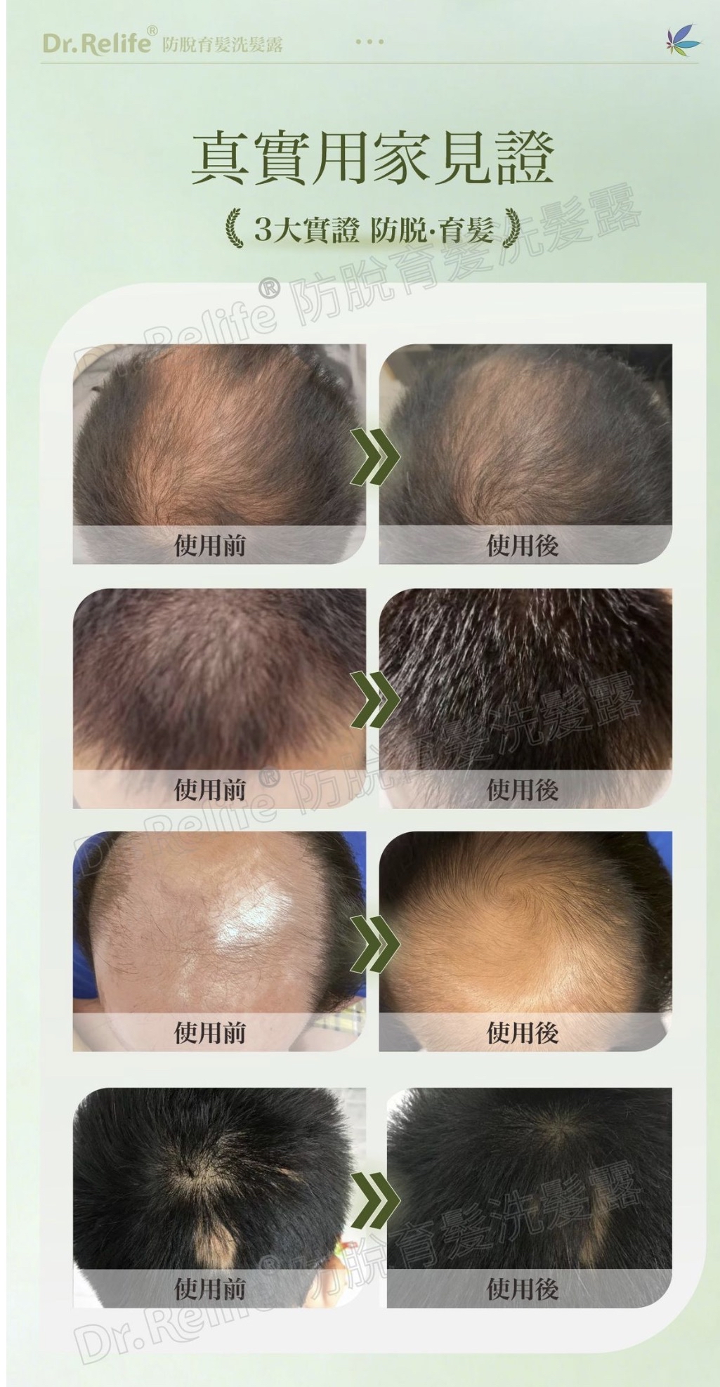 Dr.Relife 防脫洗髪露/護髮素