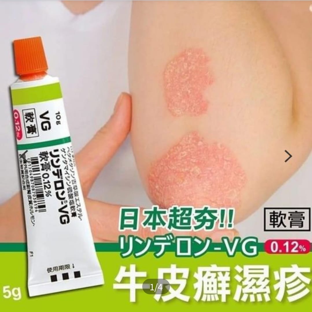 日本VG濕疹牛皮痛軟膏5g