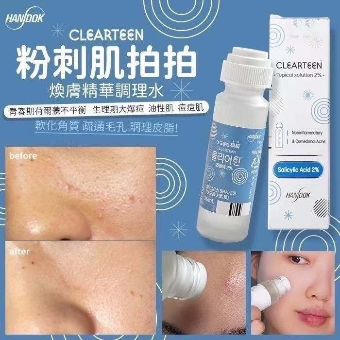 *🇰🇷韓國藥房出品Handok祛痘水 30ml*