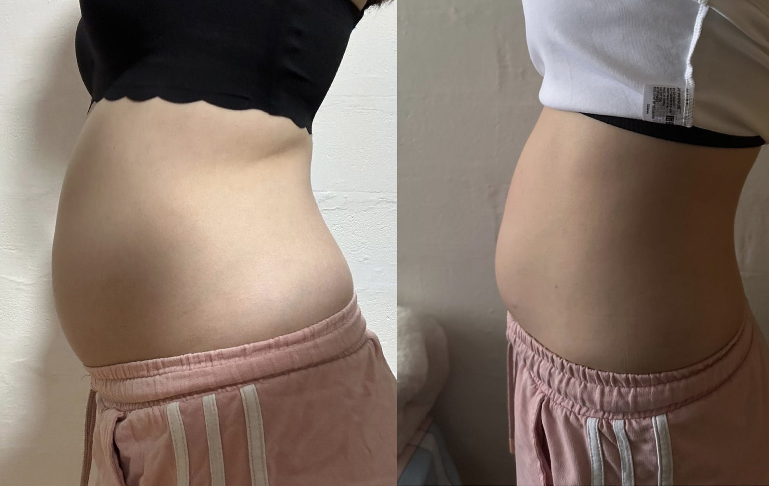 🇲🇾 5 盒 完整一个疗程配套 （ 可服用 30-45 天 ）