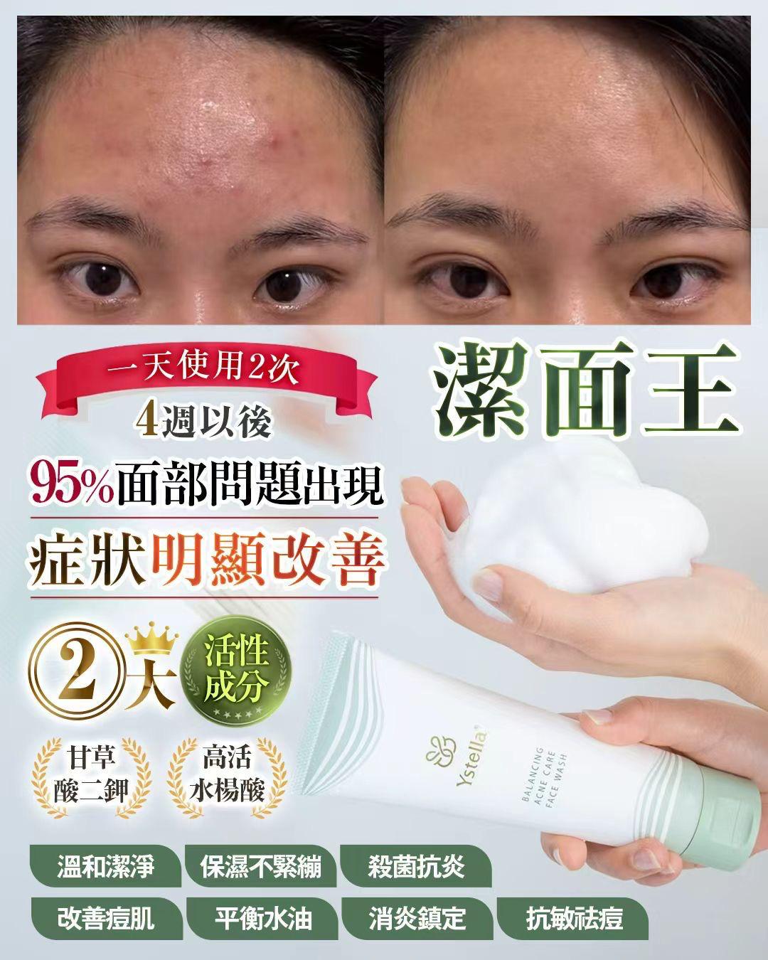 日本製Ystella潔面王   送潔面網