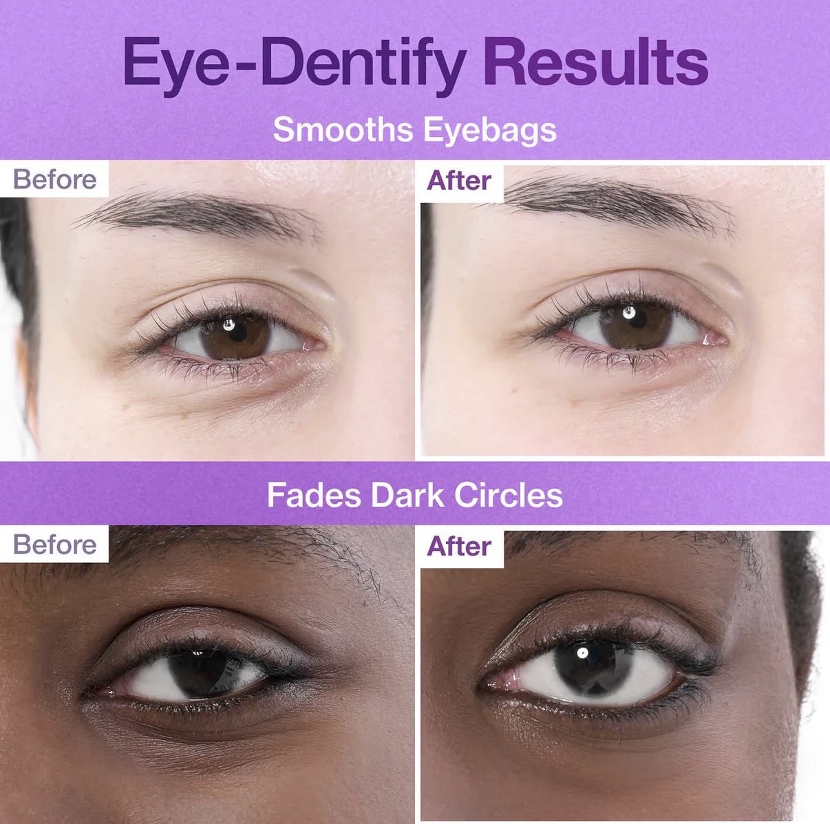 numbuzin No.9 NAD+ 果凍眼膜5對