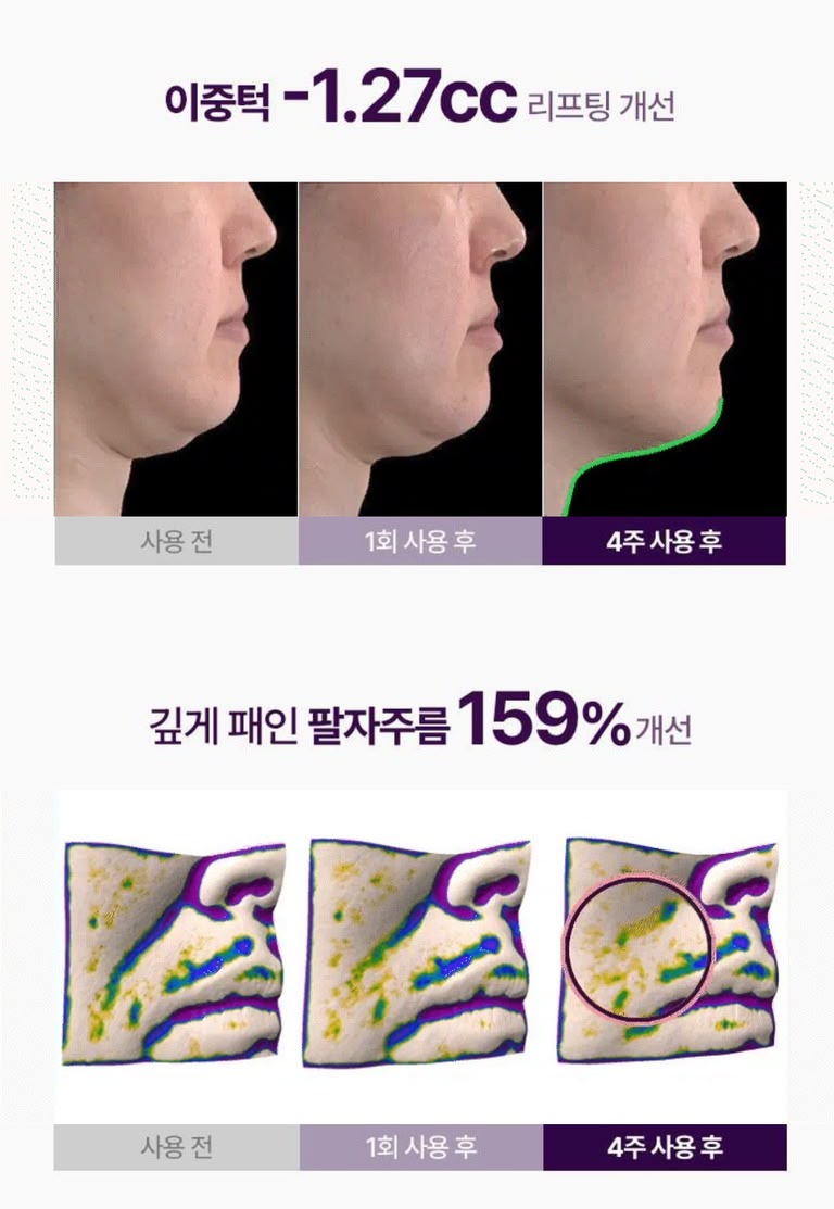 韓國🇰🇷直送✈️MEDITHERAPY V臉塑顏 緊緻面膜 5片/盒