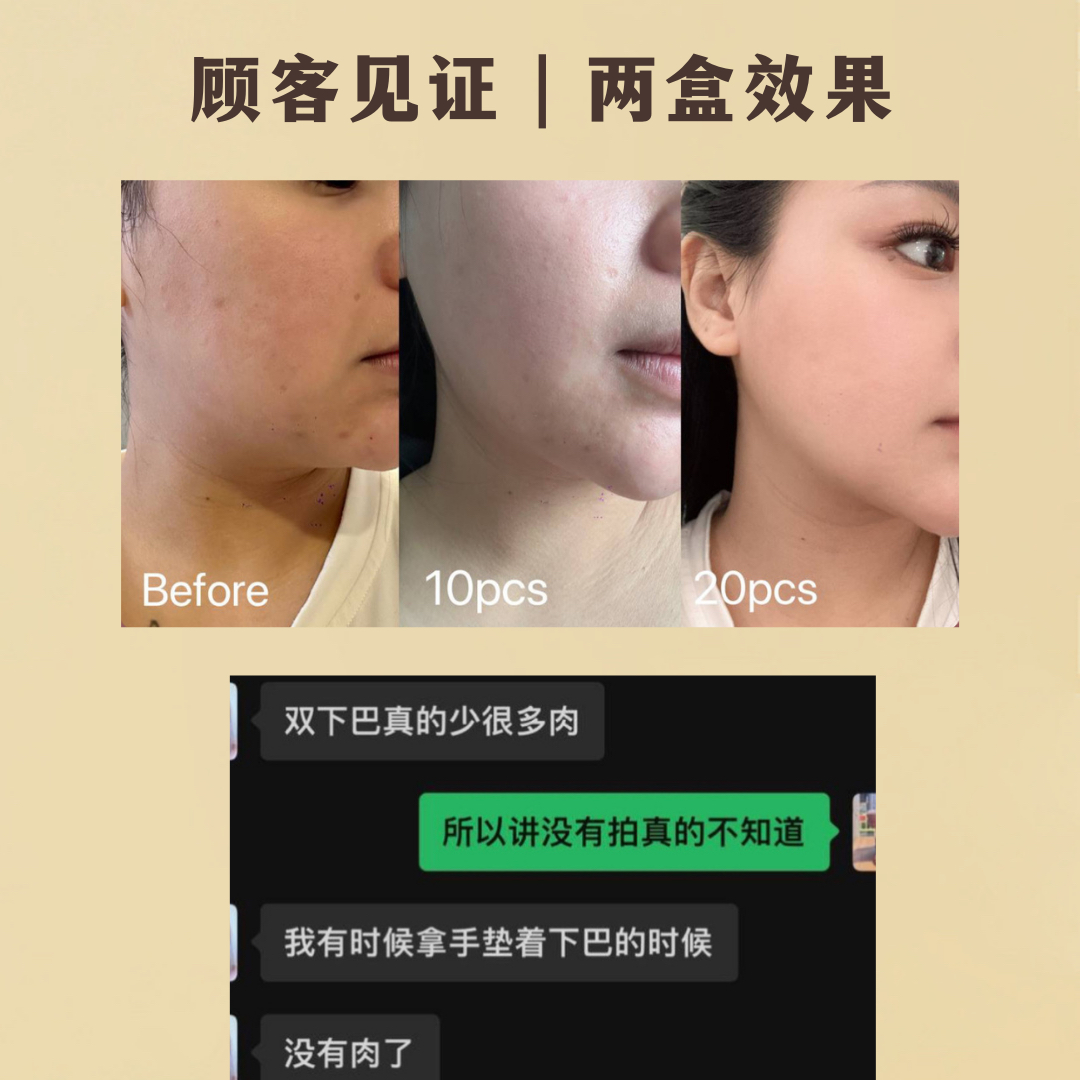 REVERIE瘦脸面膜-热销款