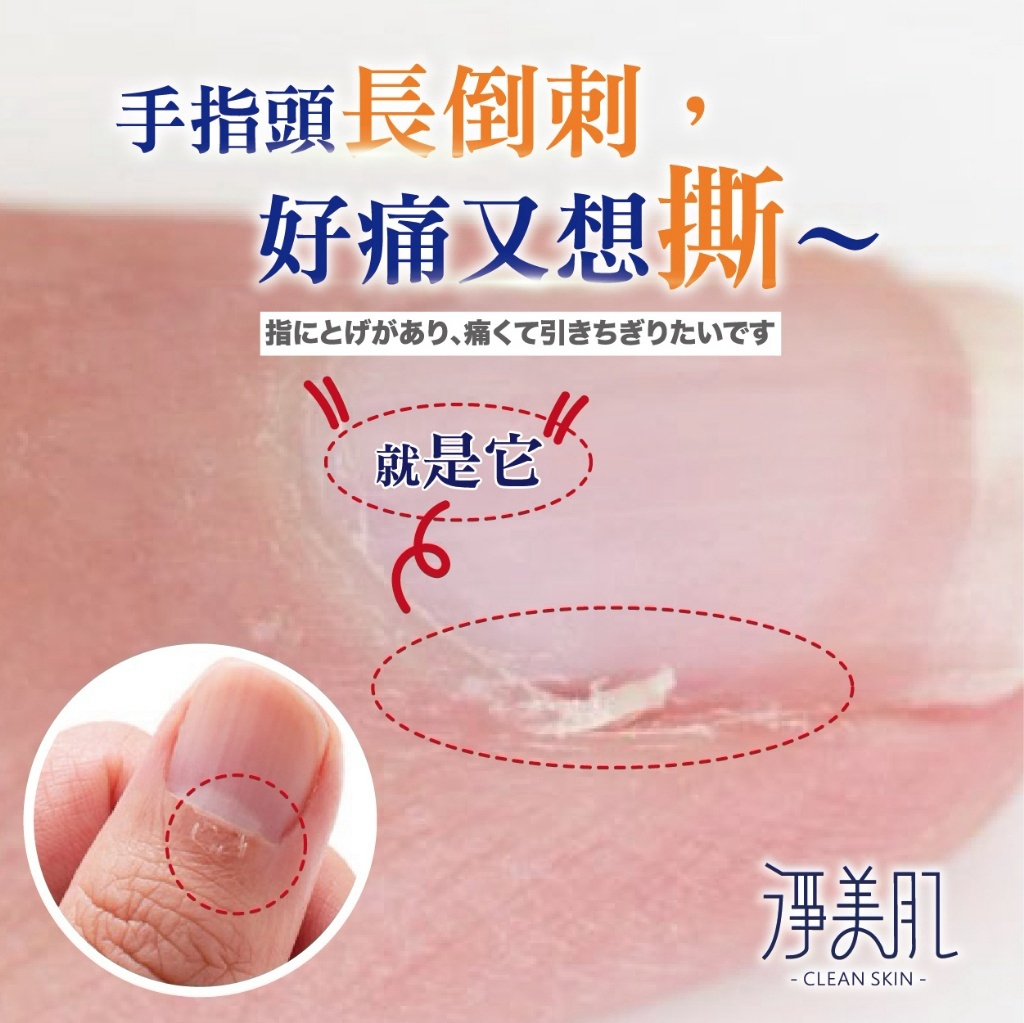 ＜限時預購＞ 淨美肌 死皮角質軟化液 30ML TW261026S01 《30/10截單，預計11月下旬到港》