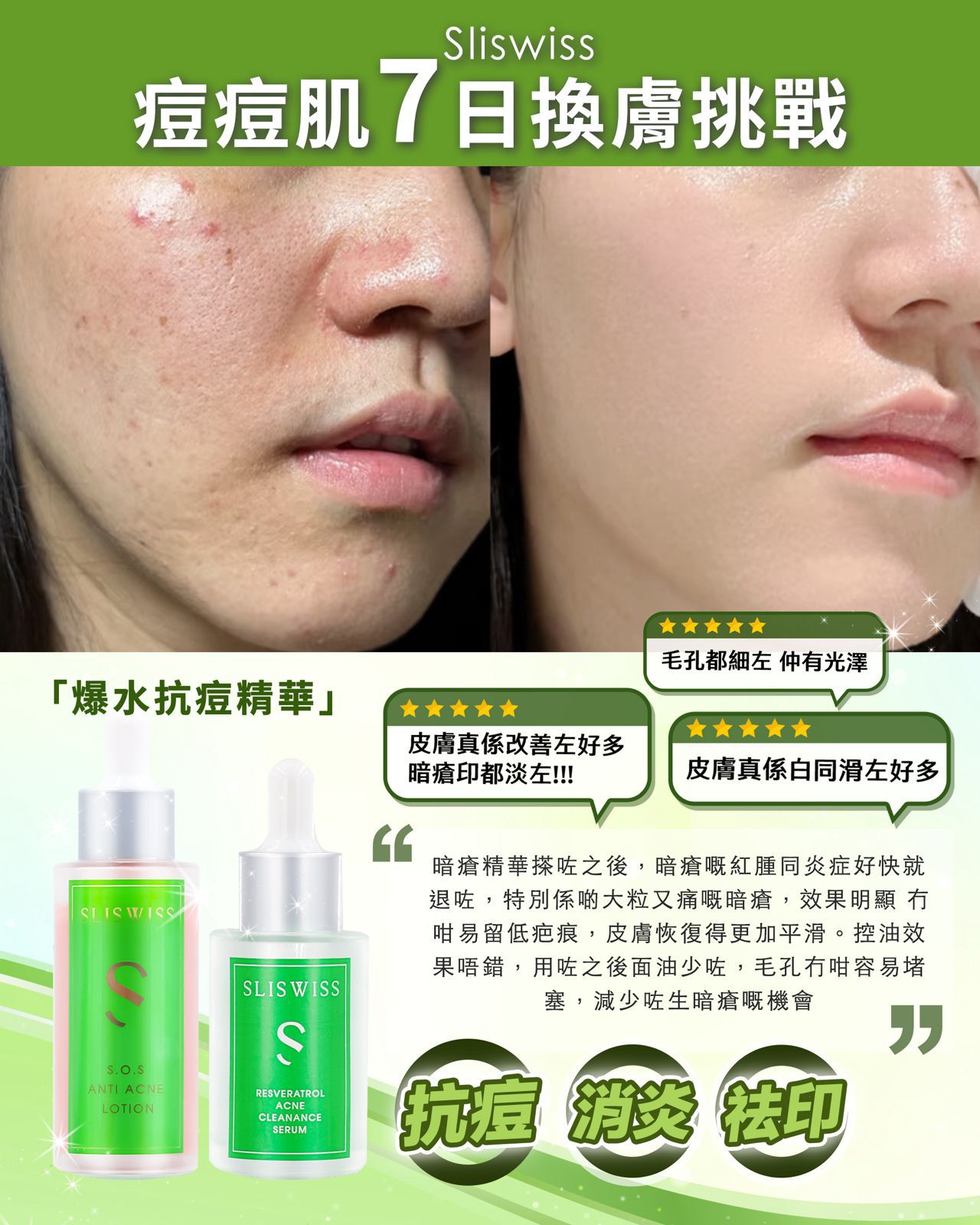 Sliswiss 白藜蘆醇急救爛面孖寶 (急救爛面精華30ML＋急救鉗清水50ML)