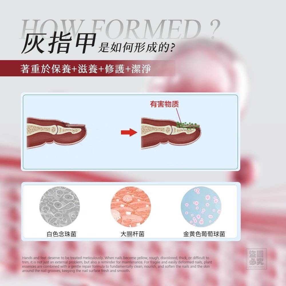 $58支。2支起$48支。台灣生醫廠 灰指甲滋養膏15ml