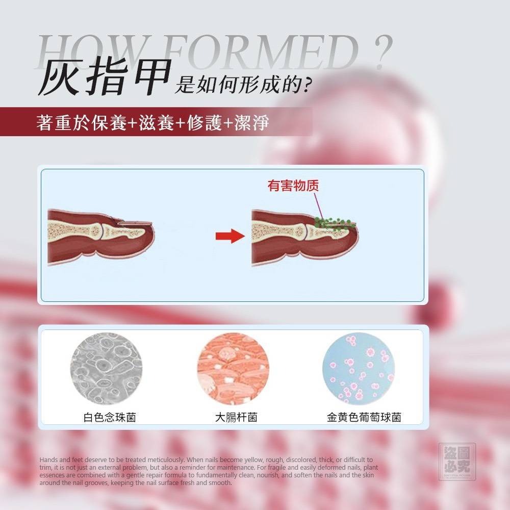 台灣生醫廠 灰指甲滋養膏15ml