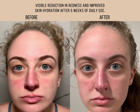 Free + True 藍調艾菊修護精華液