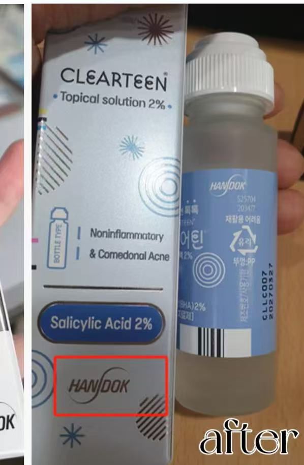 韓國藥房熱賣 HANDOK Acne Clearteen 水楊酸祛痘抗粉刺抗痘水 – 30ml