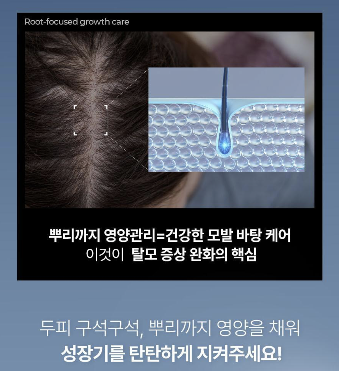 韓國 Epais 強韌髮根 頭皮精華 150ml ｜Scalp Boosting Ampoule 