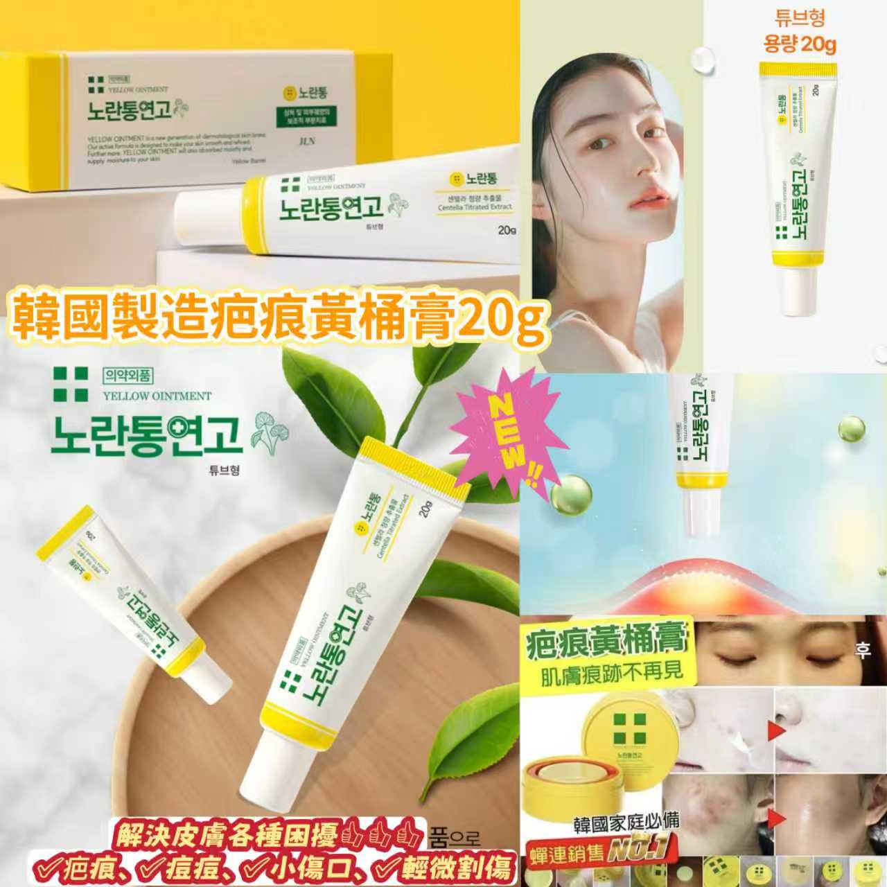 韓國製造疤痕黃桶膏20g  (現貨品)