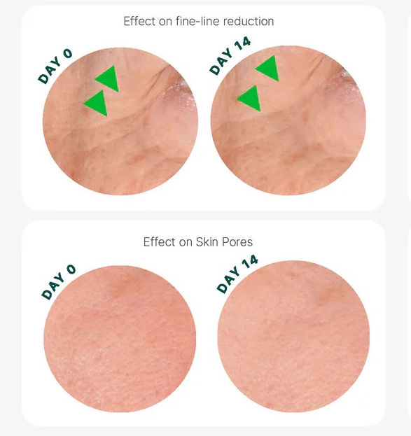 Sonage AI 胜肽膠原眼袋槍精華 A-Eye Peptide Serum™ 15ml