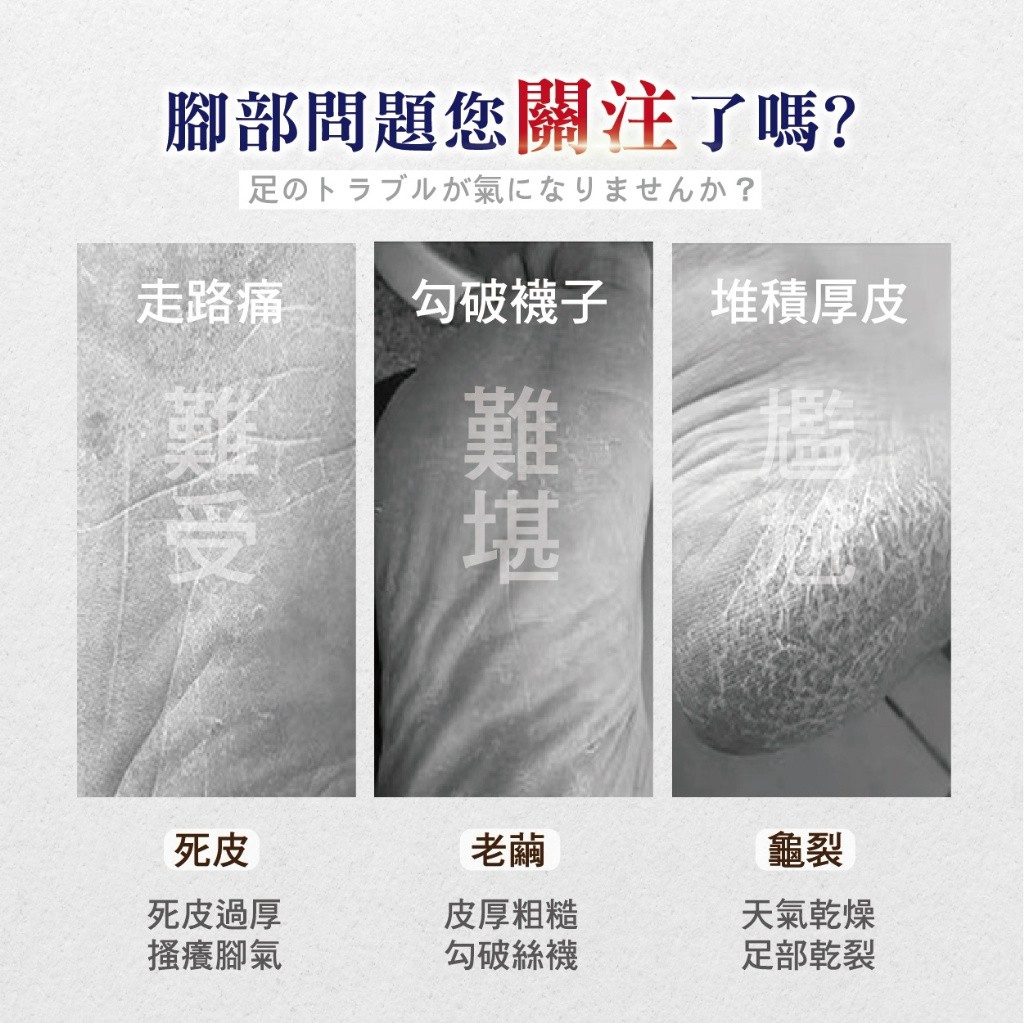 ＜限時預購＞ 淨美肌 死皮角質軟化液 30ML TW261026S01 《30/10截單，預計11月下旬到港》