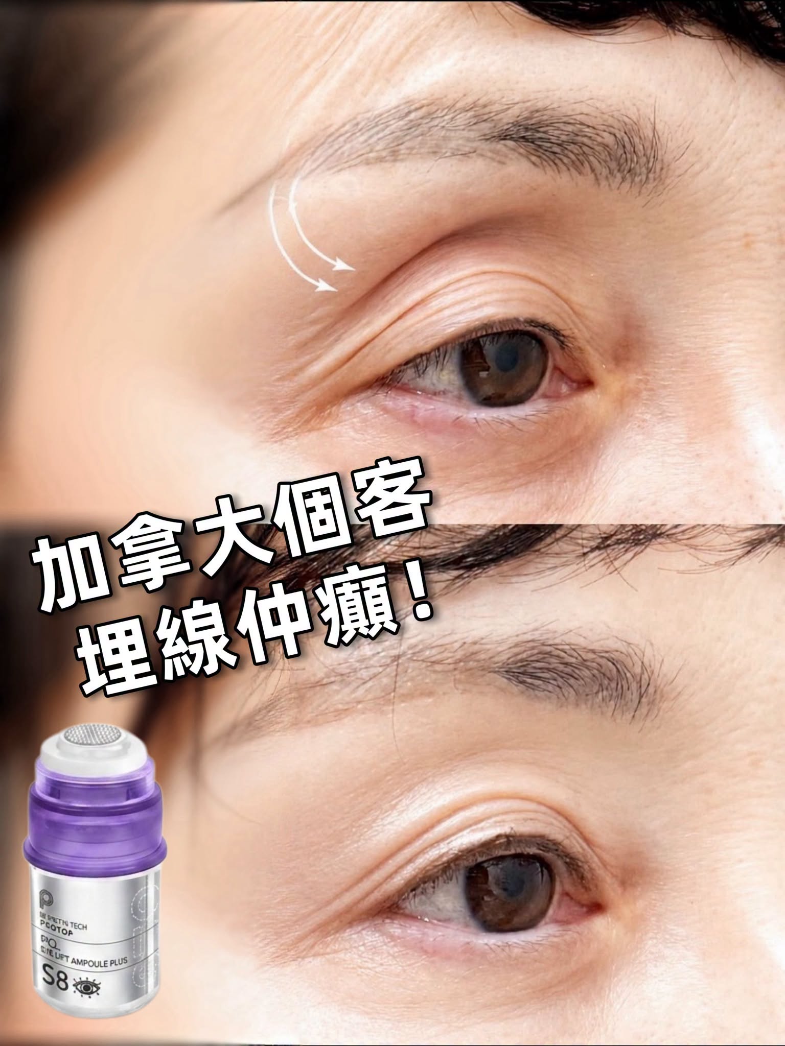 Protop S8 PCL 少女針眼部微針精華 (3ml)