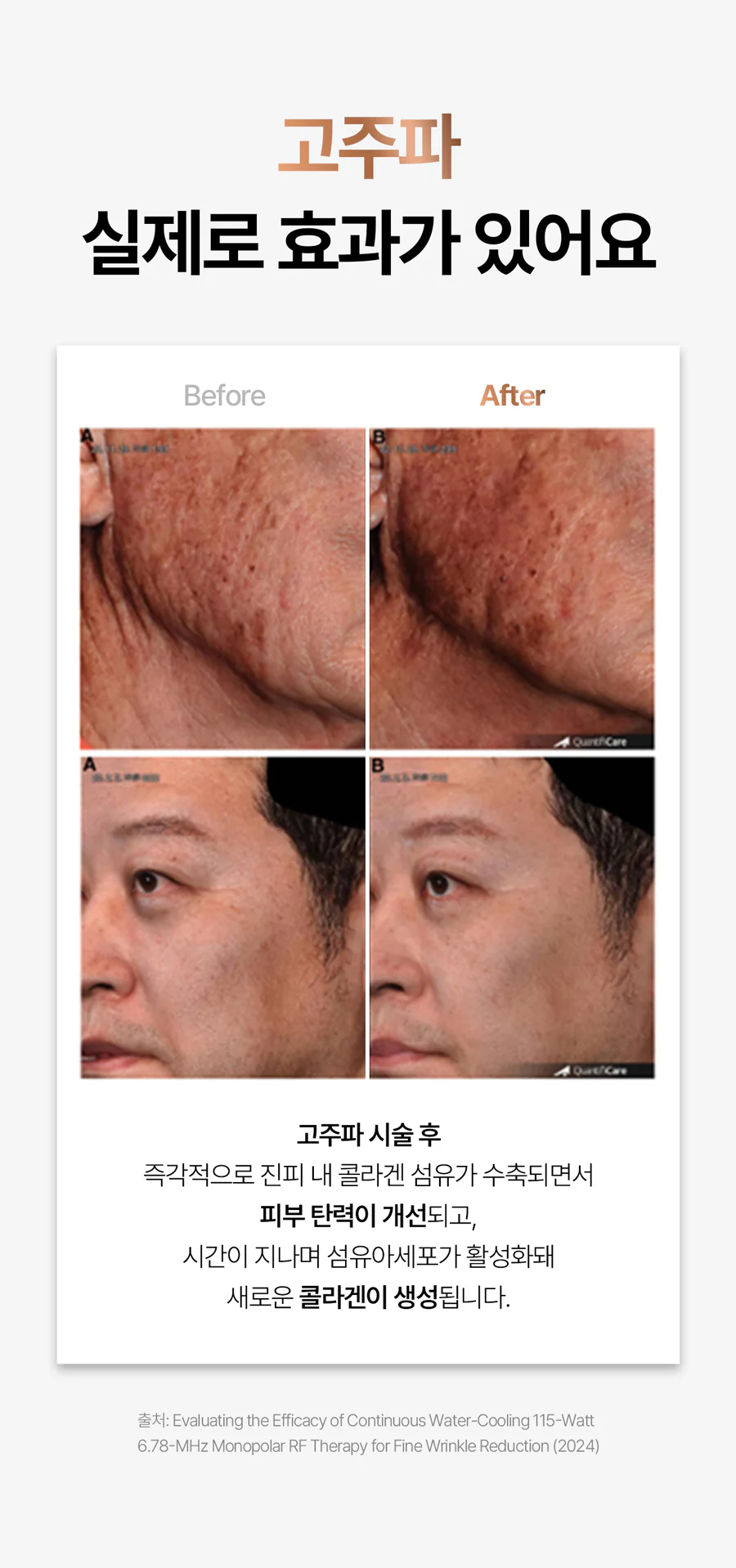 Oligio 第一部全效家用美容儀 - Oligihome 