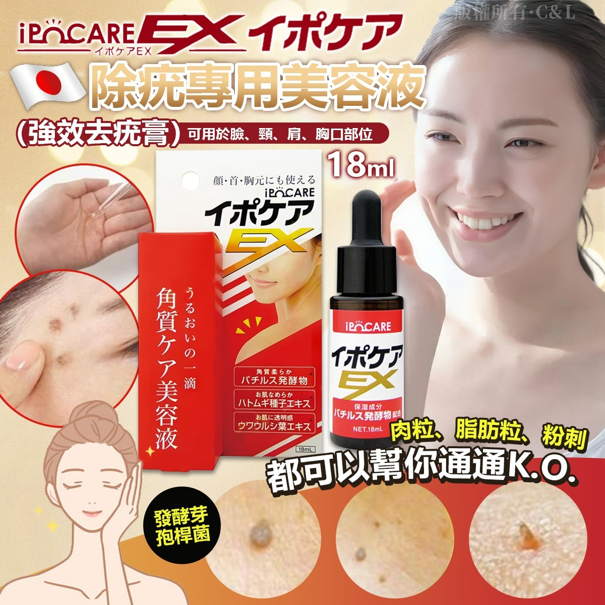 【預訂】日本IPOCARE 除疣專用美容液 18ml（新版）