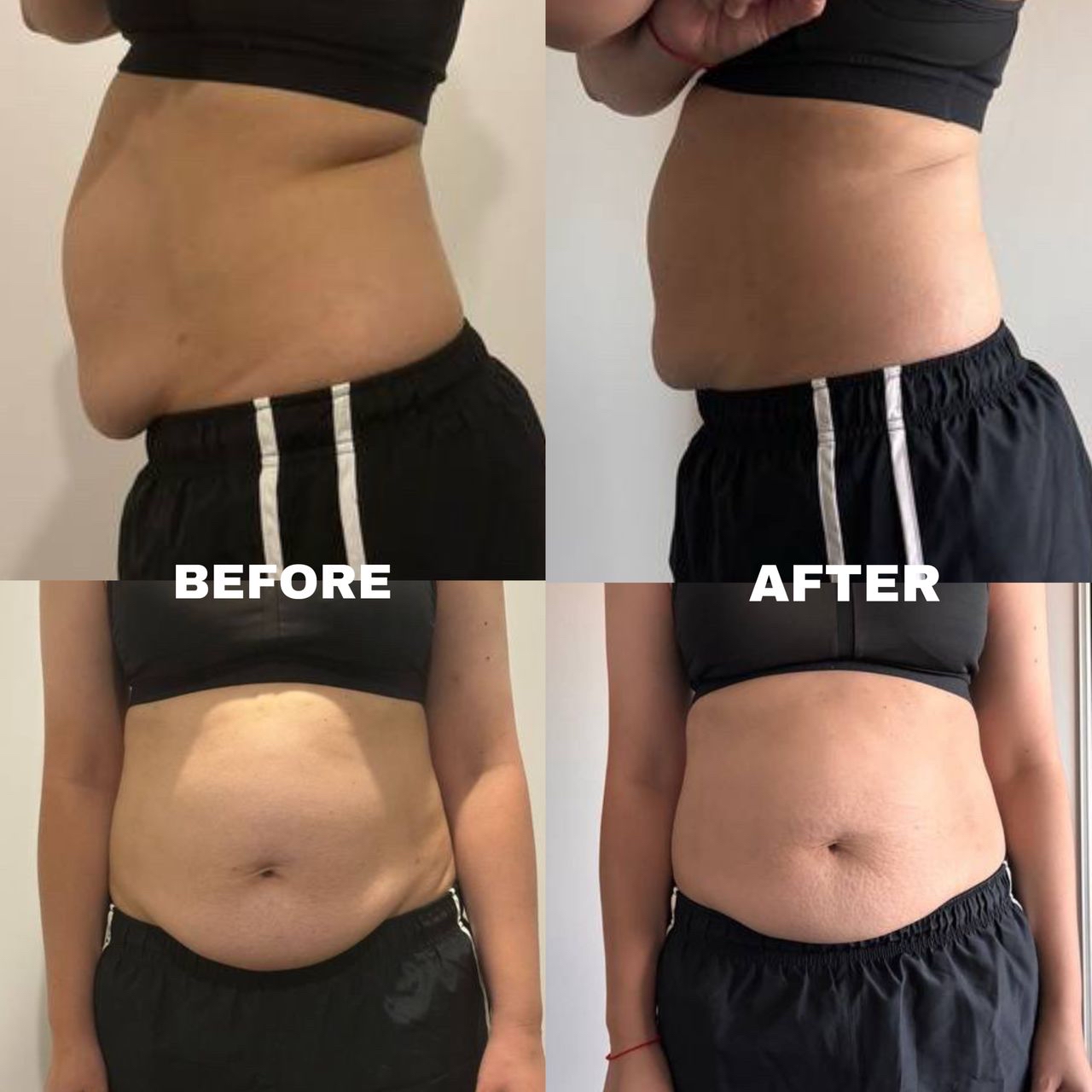 🇲🇾 10 盒 最畅销 VVIP 疗程配套（ 可服用 60-75天 ）