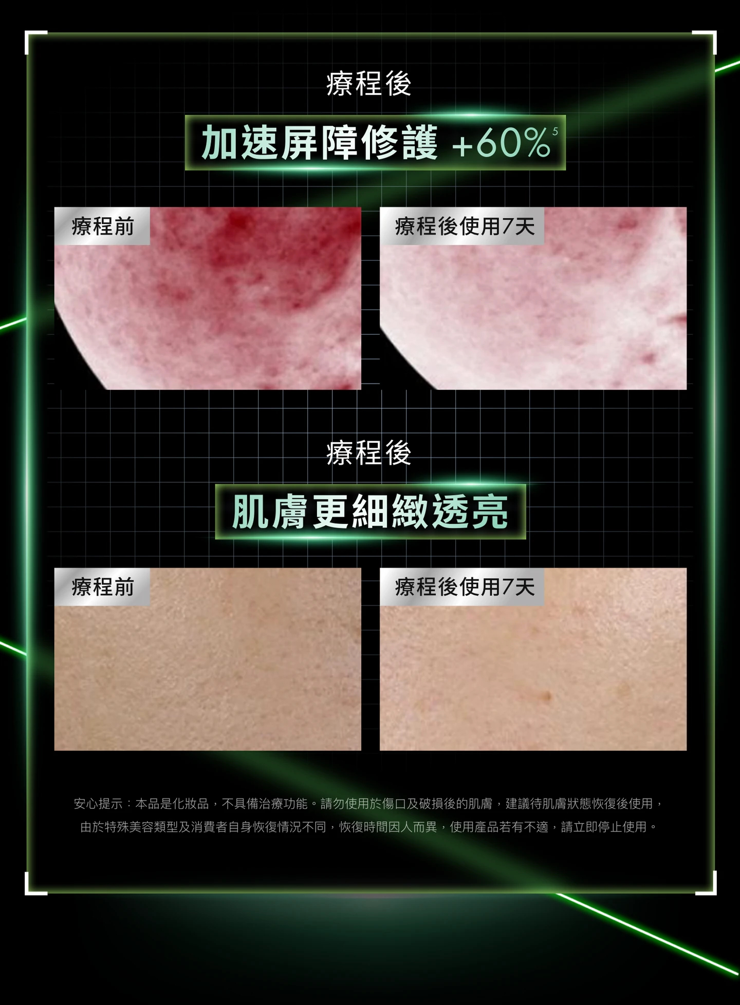 加拿大直送 SkinCeuticals  SkinCeuticals 修麗可】植萃極速舒緩色修面膜60ml 