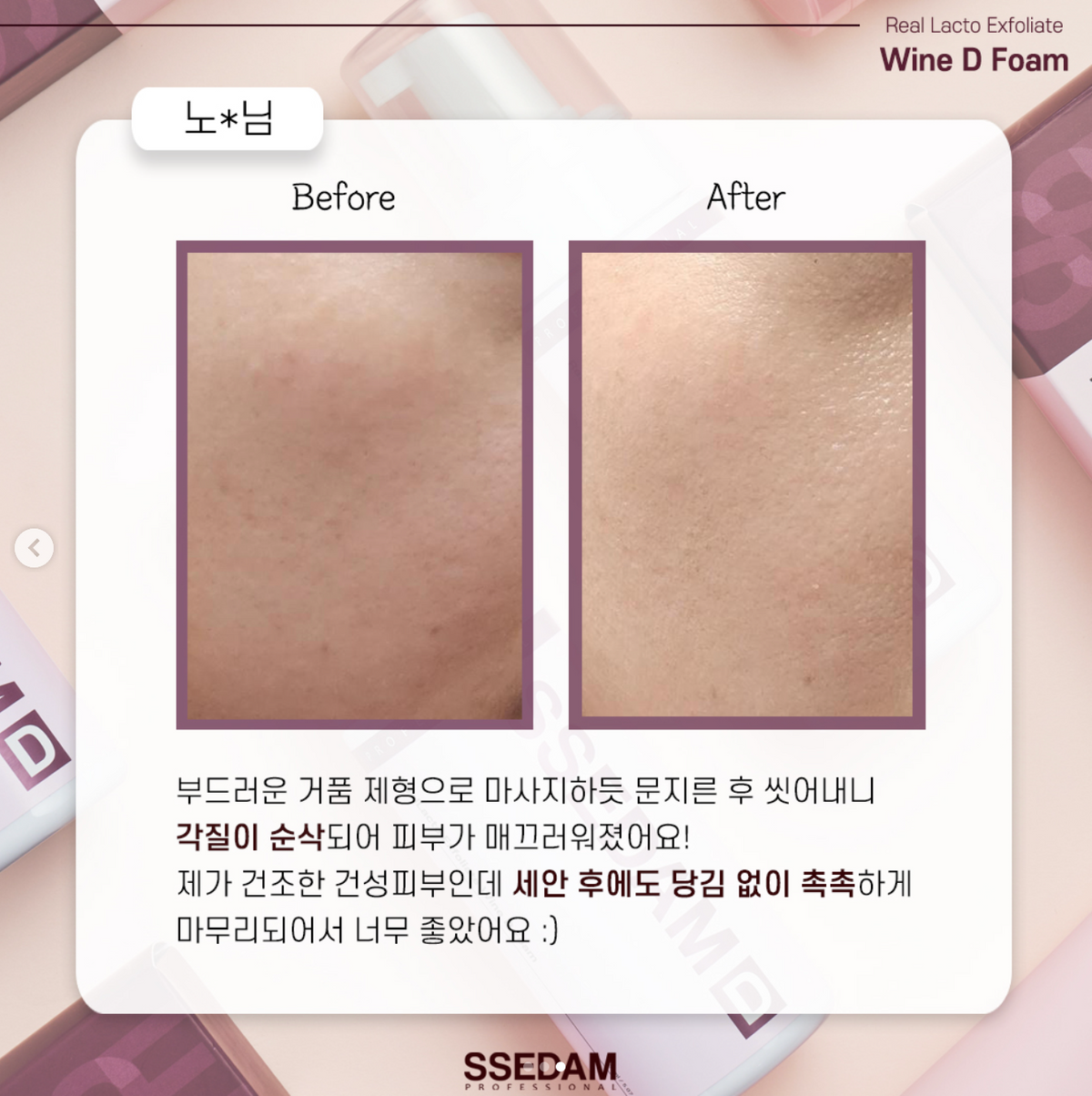 💥On Sale：        🫧SSEDAM *Real Lacto Exfoliate Wine D Foam 紅酒鮮奶油去角質泡沫 /150ml