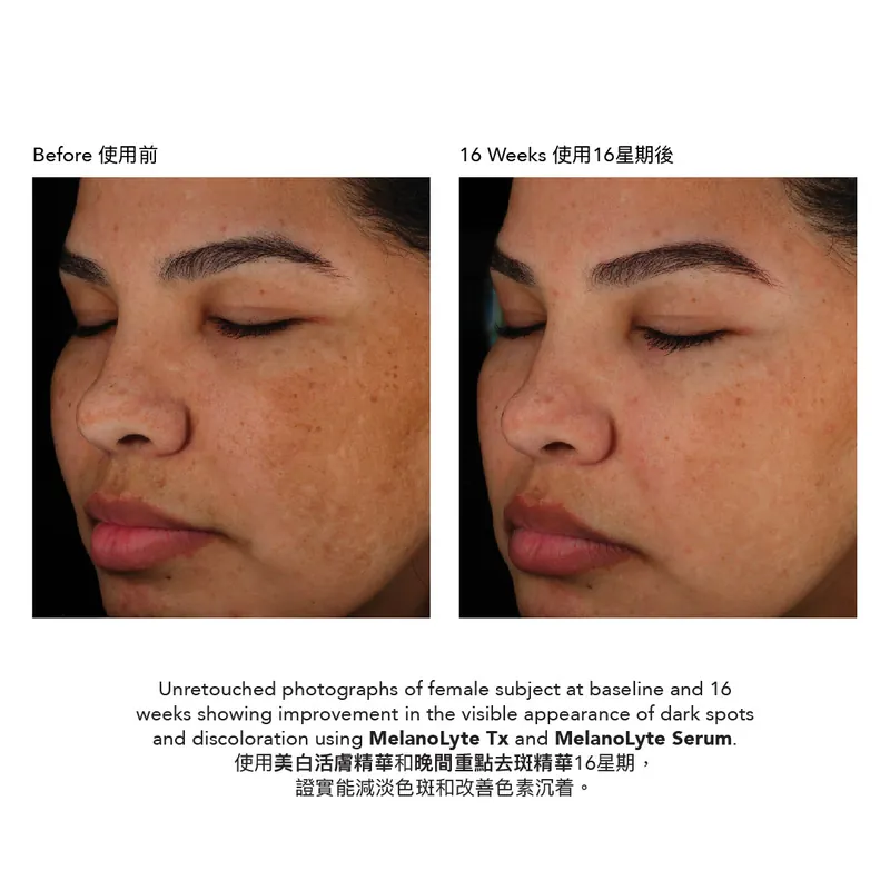 Epionce MelanoLyte Serum 晚間重點去斑精華 BBE 7/26