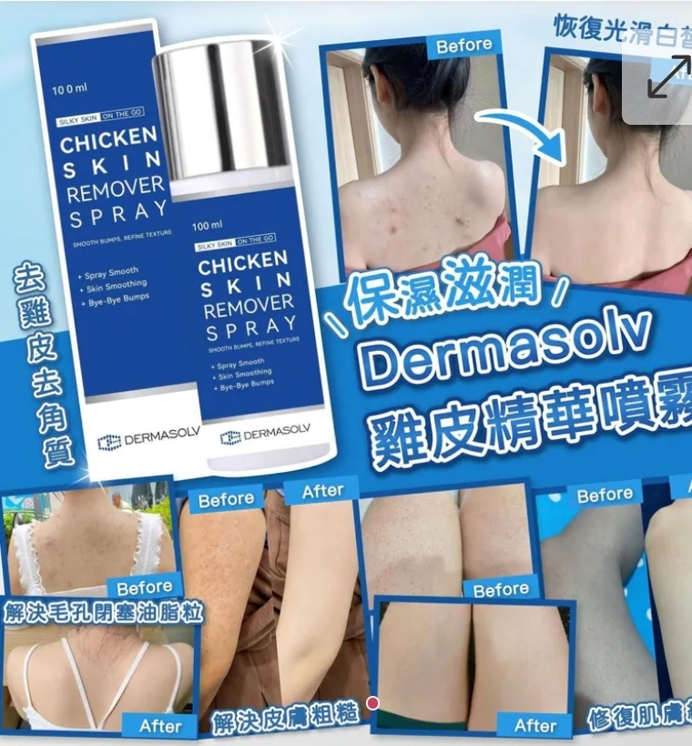 $88支.2支或以上每支$78支.Dermasolv雞皮精華噴霧100ml