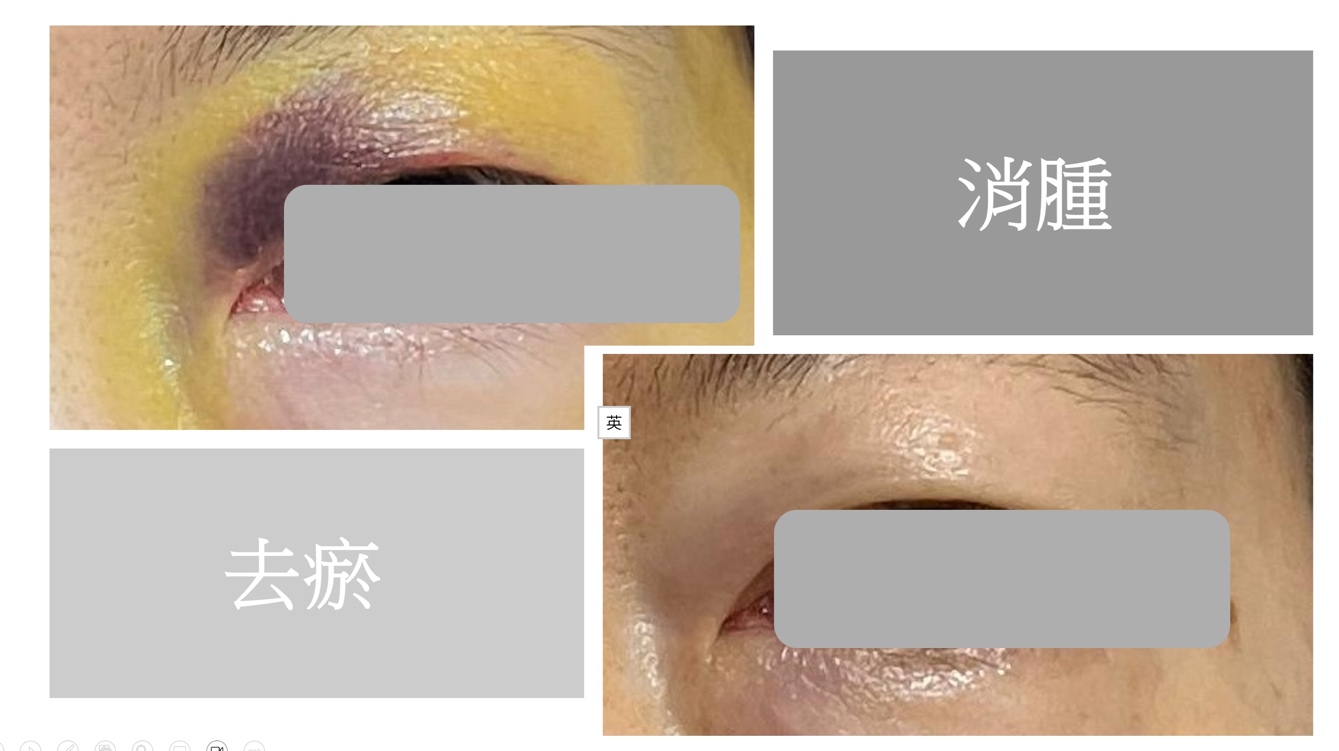 有機扁桃斑鳩菊油膏(嬰兒款)-蚊叮蟲咬/消腫止痕/濕疹/尿布疹及奶癬