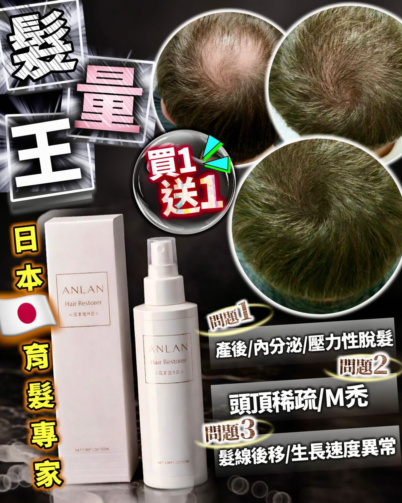 預購｜日本ANLAN🇯🇵髮快生 育髮精華