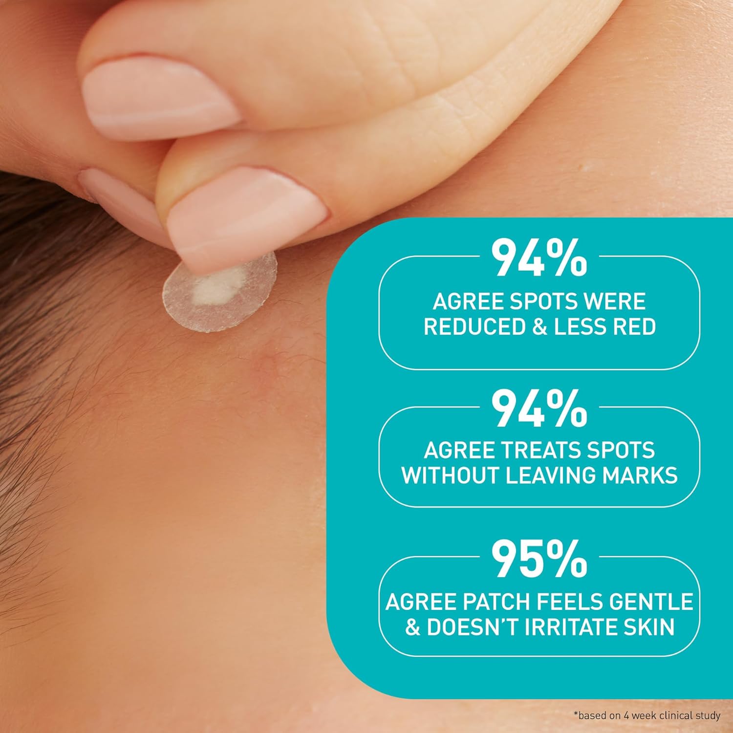 CeraVe - 有效吸油控油暗瘡貼