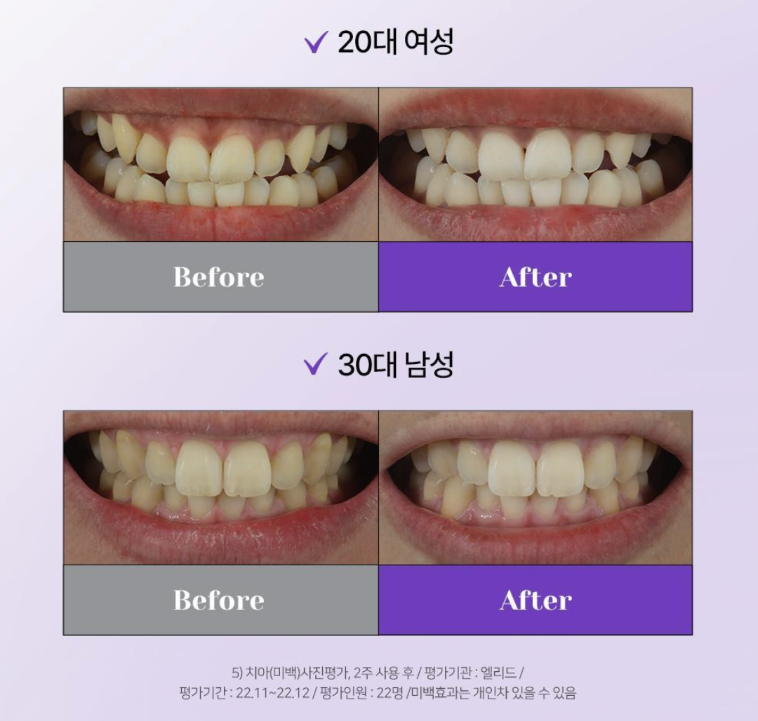 韓國 EUTHYMOL X HUNTER 紫色美白 皇牌 3 件套 ＋ 3WAY 潮流索繩袋 （顏色隨機）｜Purple Whitening Set