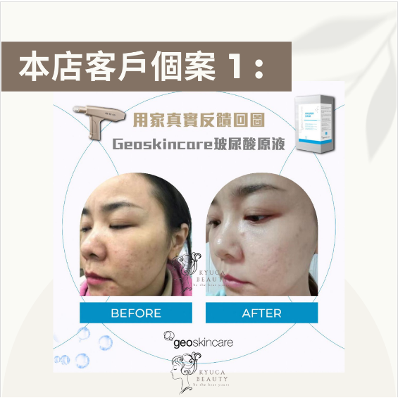 【 居家必備 】玻尿酸保濕精華原液 ( 一盒8支 )