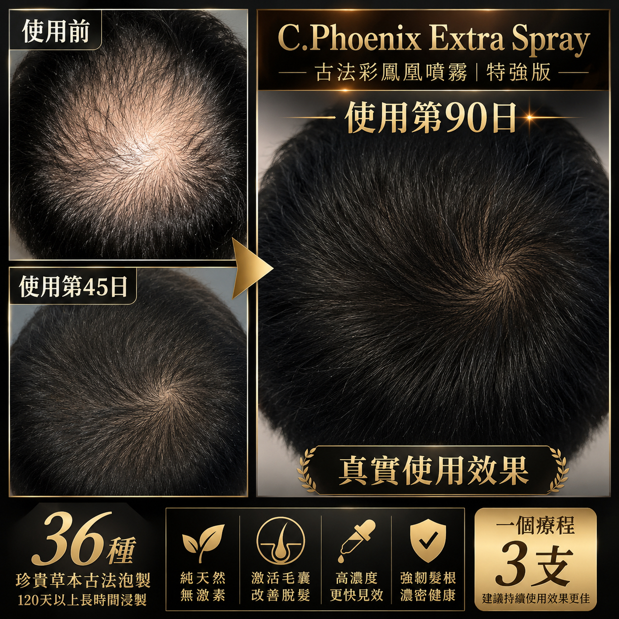12/5出貨 【C.Phoenix Extra Spray】[特強版] 效果更快更強‼️此產品*有植物藥渣會染色[植物色素純天然無害]及味道較為強烈*
