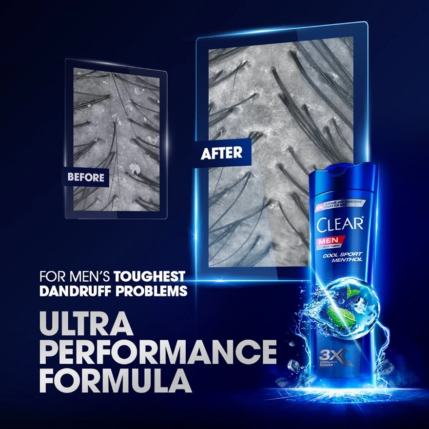 Clear Men Shampoo 170ml - Cool Sport Menthol