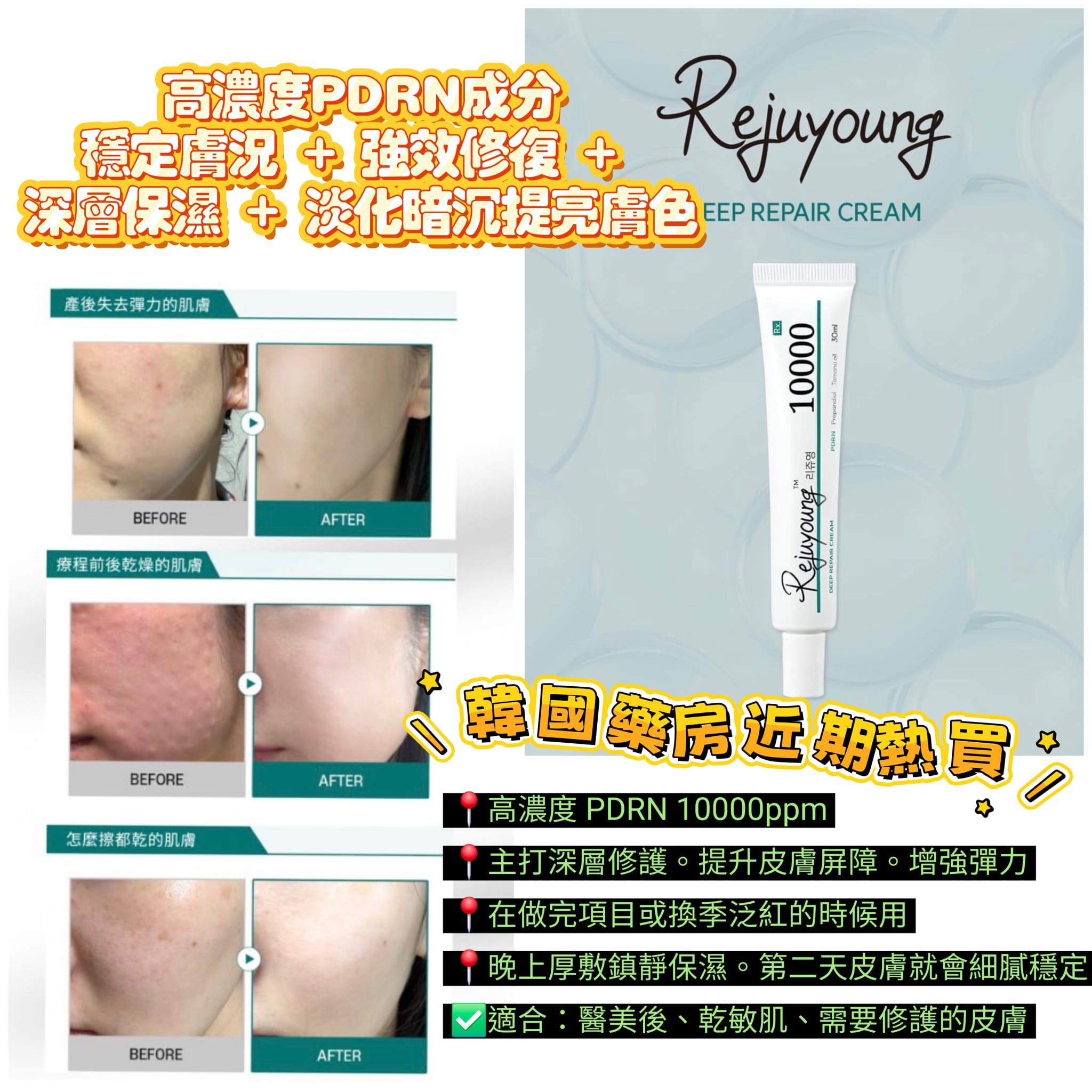 韓國藥妝熱爆瘋搶🇰🇷 RX ME 綠色 Rejuyoung PDRN 10000+ 深層修復霜 30ml