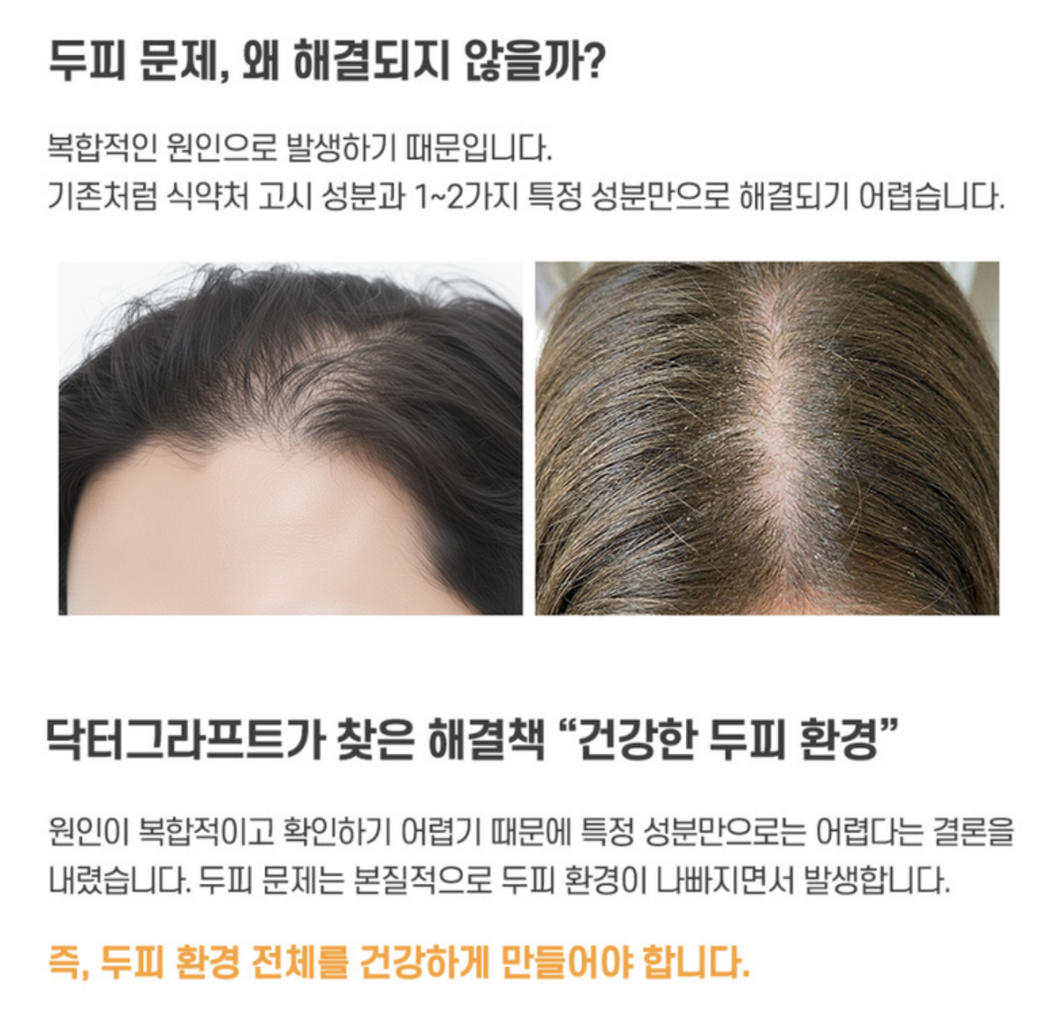 醫學生髮品牌｜韓國  Dr.Graft 植髮皇 生髮防脫 修護 洗髮水 / 精華 ｜Anti-hair Loss & Care Shampoo Tonic 