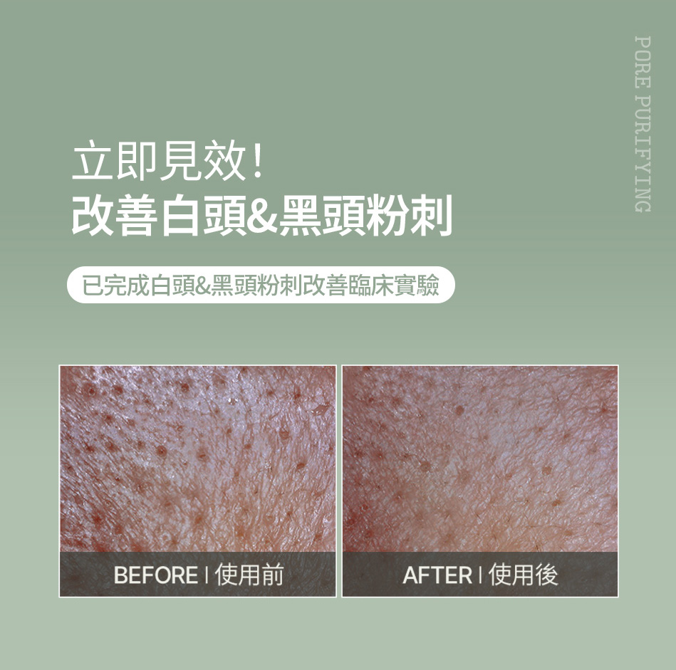 FULLY 綠番茄潔面泥膜 GREEN TOMATO CLEANSER 120ML [預計9月中出貨]