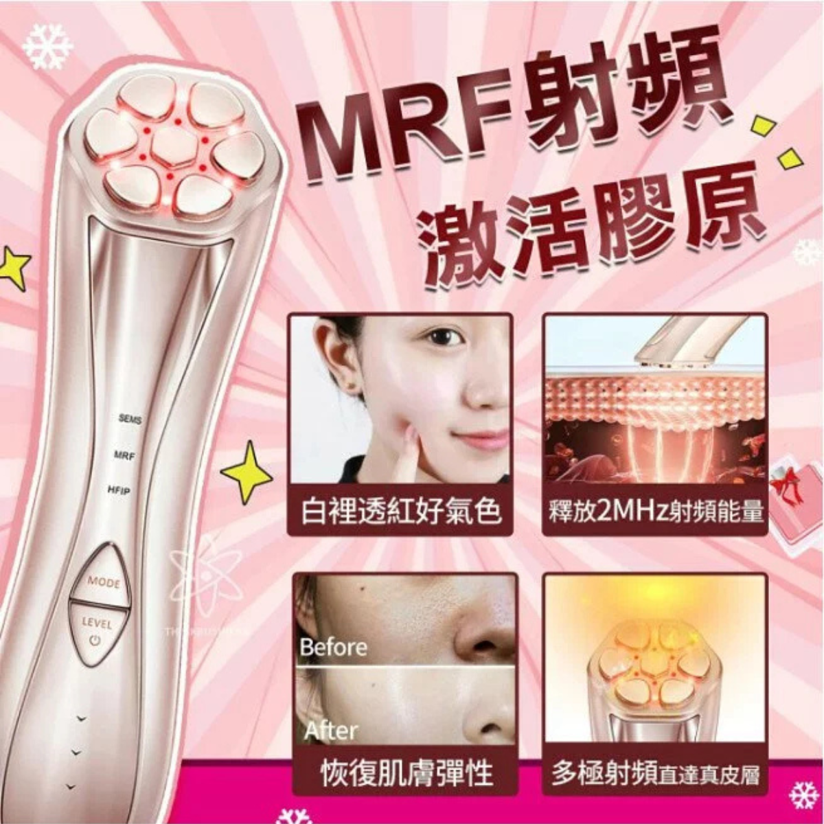 日本直送 JUJY 24K煥顏緊緻射頻機 <全新升級> (附送專用精華凝膠)丨緊緻V臉丨回復青春丨撫退皺紋丨鎖水丨日本權威博士推介 | 限時優惠【3/8 截單，預計 : 3月中至3月尾發貨】】