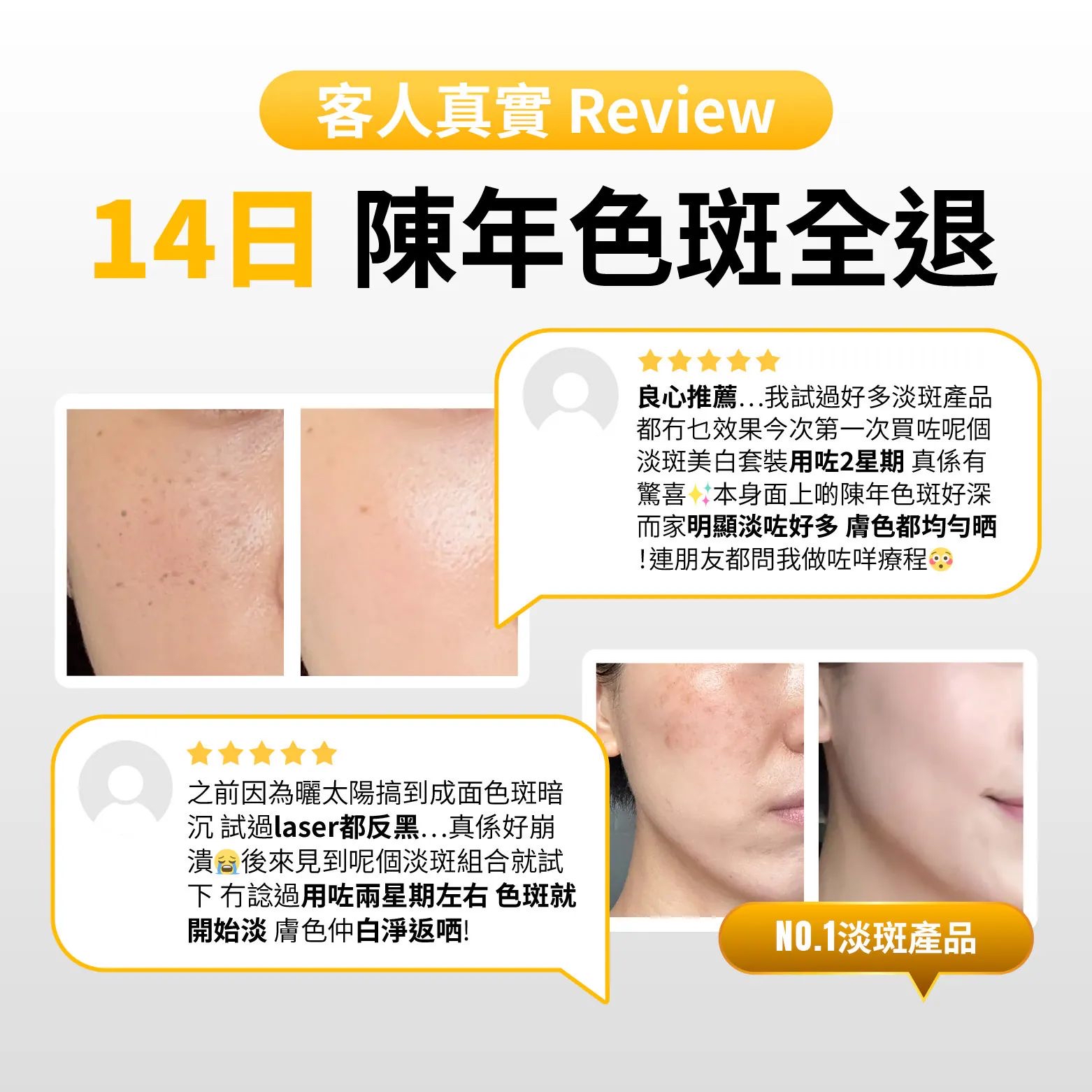 🇰🇷韓國ESSL 14日亮白淡斑修復套裝（亮白淡斑霜30ml + 貼片8片）