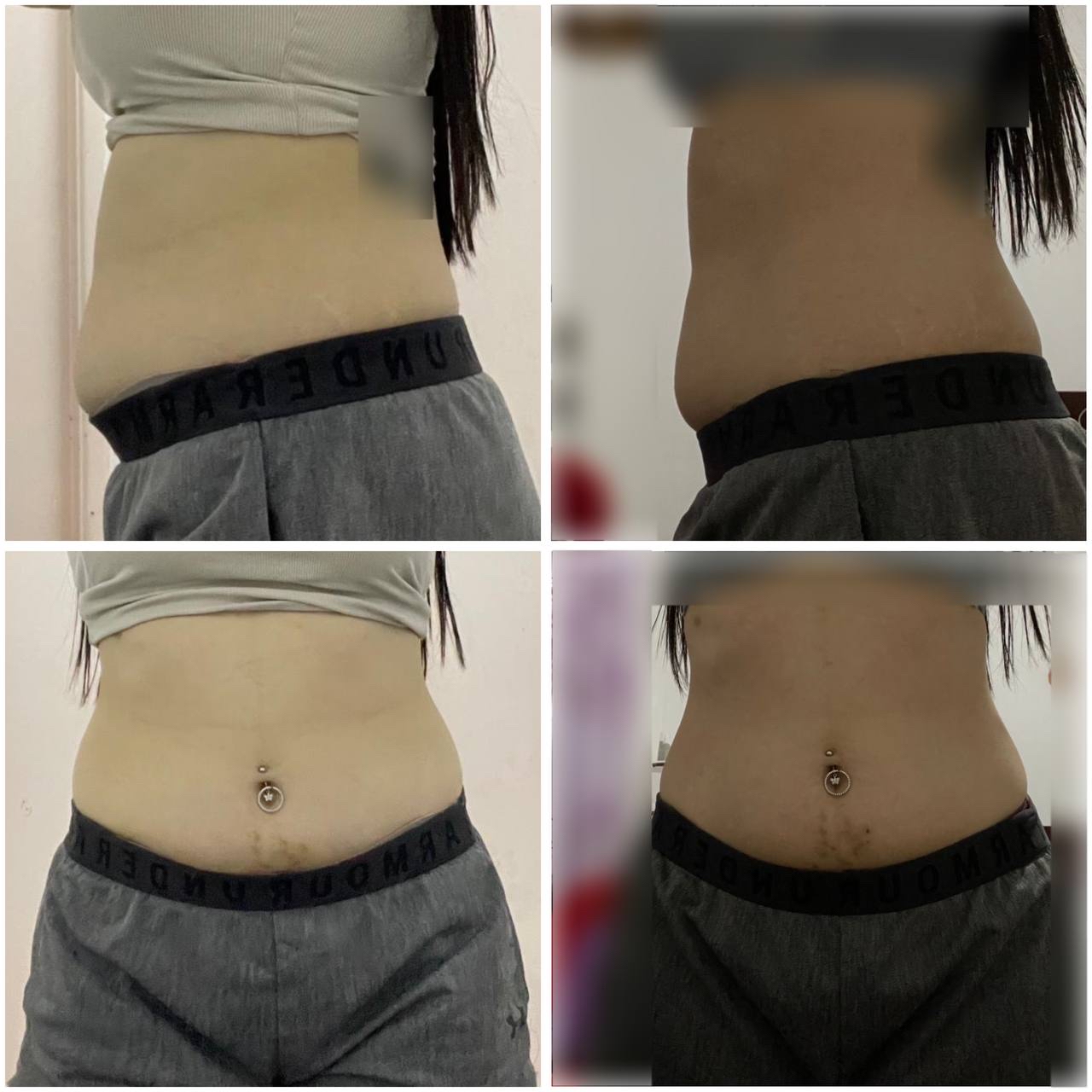 🇲🇾 10 盒 最畅销 VVIP 疗程配套（ 可服用 60-75天 ）