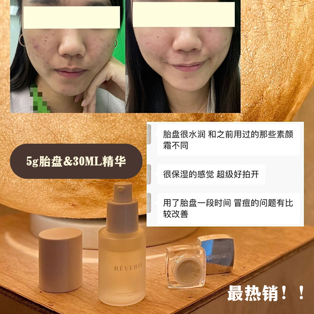 精华+胎盘膏组合（最热销）