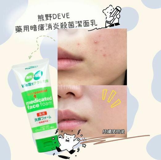 KUMANO熊野 藥用暗瘡消炎殺菌潔面乳 130g -1件