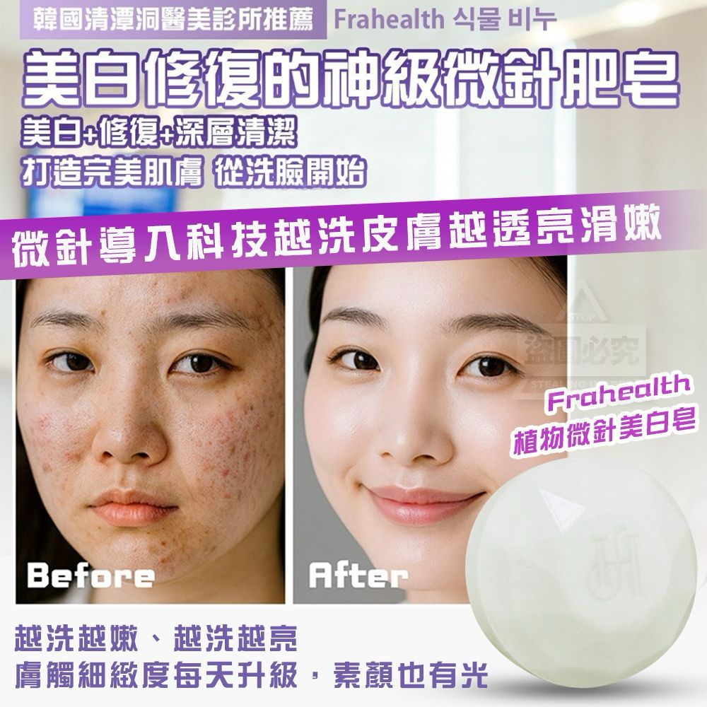 【預訂】韓國製造 Frahealth 幹細胞 PDRN 再生亮白微針皂 (1套2件)