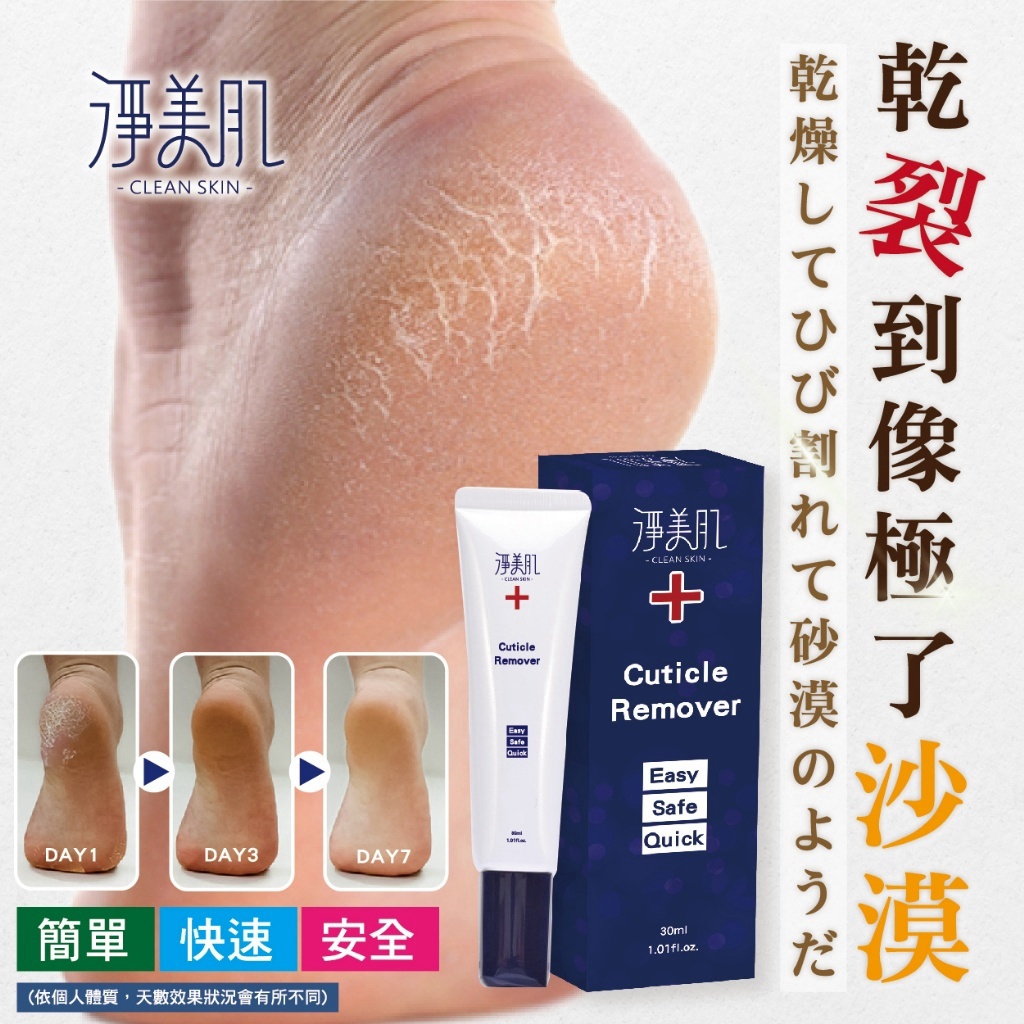 ＜限時預購＞ 淨美肌 死皮角質軟化液 30ML TW261026S01 《30/10截單，預計11月下旬到港》