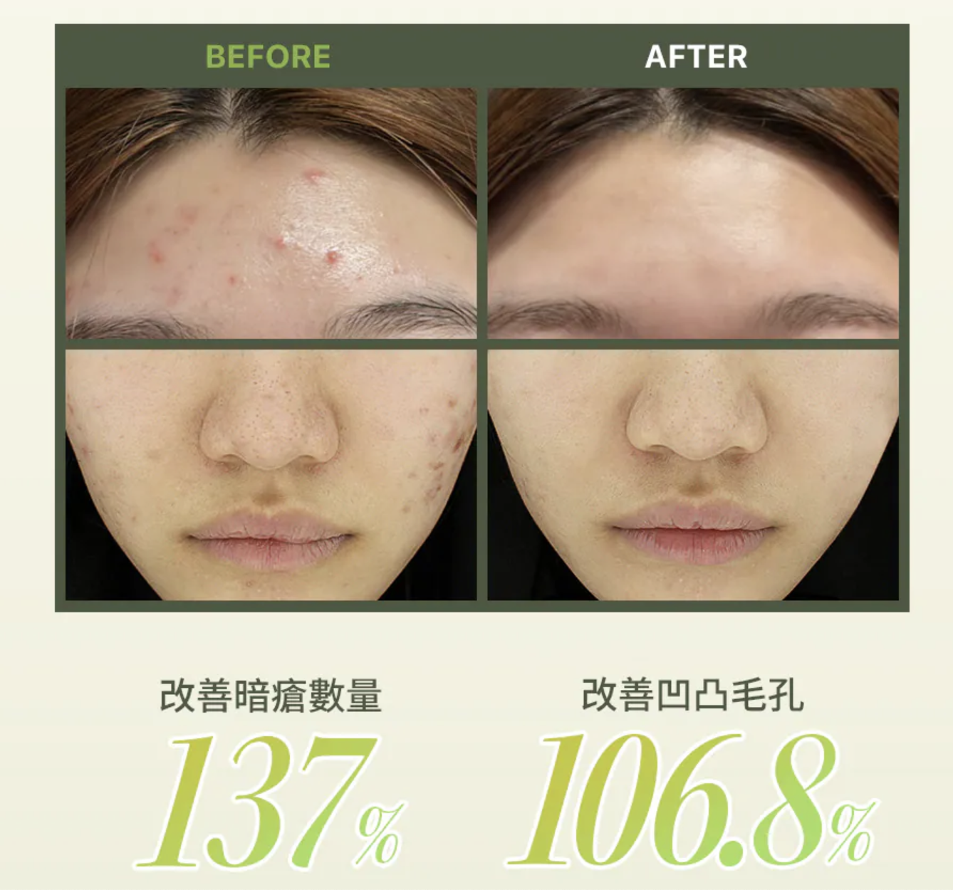 韓國 EIOM 毛孔緊緻 痘痘修護 爽膚棉 70片/盒｜Trouble Control Pad